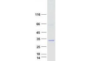 Validation with Western Blot (NAT15 Protein (Transcript Variant 2) (Myc-DYKDDDDK Tag))