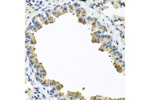 Immunohistochemistry of paraffin-embedded mouse lung using SERPINA3 antibody (ABIN5970399) at dilution of 1/100 (40x lens). (SERPINA3 Antikörper)