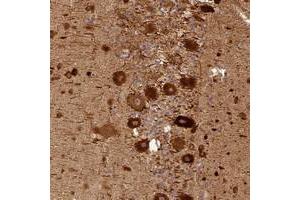Immunohistochemical staining of human cerebellum with BCDIN3D polyclonal antibody  shows strong cytoplasmic positivity in purkinje cells at 1:50-1:200 dilution.