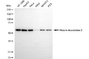 Western blotting analysis using histone deacetylase 2 antibody (ABIN7798931).