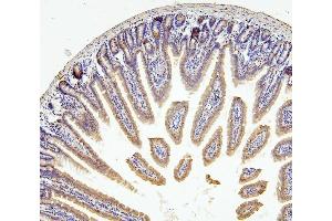 IHC analysis of RNF169 using anti-RNF169 antibody (ABIN6719530). (RNF169 Antikörper  (AA 311-708))