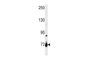 SLC28A1 Antibody (Center) (ABIN1881811 and ABIN2843229) western blot analysis in ZR-75-1 cell line lysates (35 μg/lane). (SLC28A1 Antikörper  (AA 381-409))
