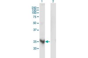 Western Blot analysis of MARCH3 expression in transfected 293T cell line by MARCH3 monoclonal antibody (M03), clone 1F6. (MARCH3 Antikörper  (AA 1-100))