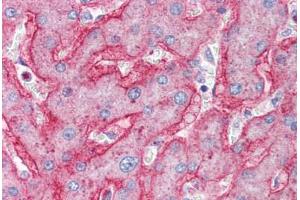 Human Liver (formalin-fixed, paraffin-embedded) stained with ENPP1 antibody ABIN337063 at 2. (ENPP1 Antikörper  (AA 915-925))