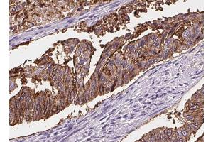 ABIN6268717 at 1/100 staining Human lung tissue by IHC-P. (Aquaporin 5 Antikörper  (C-Term))