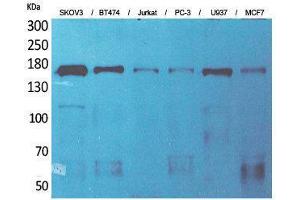 Western Blotting (WB) image for anti-Sterol Carrier Protein 2 (SCP2) (Internal Region) antibody (ABIN3187668) (SCP2 Antikörper  (Internal Region))