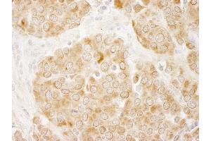 Immunohistochemistry (IHC) image for anti-Insulin Receptor Substrate 1 (IRS1) (AA 1192-1242) antibody (ABIN7448979) (IRS1 Antikörper  (AA 1192-1242))