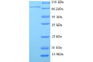 SDS-PAGE (SDS) image for serpin Peptidase Inhibitor, Clade F (Alpha-2 Antiplasmin, Pigment Epithelium Derived Factor), Member 1 (SERPINF1) (AA 21-418) protein (GST tag) (ABIN5710348) (PEDF Protein (AA 21-418) (GST tag))