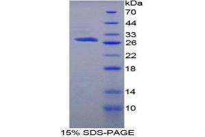 SDS-PAGE (SDS) image for Protein S (PROS) (AA 416-646) protein (His tag) (ABIN1879993)