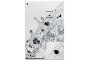 Immunohistochemistry (IHC) image for anti-Epidermal Growth Factor Receptor (EGFR) (Extracellular Domain) antibody (ABIN492658) (EGFR Antikörper  (Extracellular Domain))