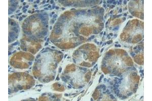 Immunohistochemistry (IHC) image for anti-Interleukin 1 Receptor, Type I (IL1R1) (AA 21-109) antibody (ABIN7430735)