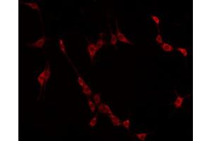 ABIN6275025 staining HuvEc by IF/ICC. (CCDC102B Antikörper  (Internal Region))