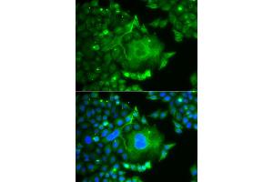 Immunofluorescence analysis of A549 cells using CACNG4 antibody (ABIN5974747). (CACNG4 Antikörper)