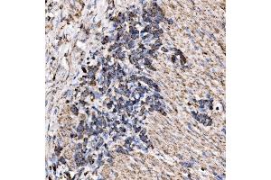 IHC analysis of RPL17 using anti-RPL17 antibody (ABIN7601639). (RPL17 Antikörper  (AA 40-167))