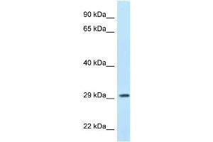WB Suggested Anti-PPP1R3B Antibody Titration: 1. (PPP1R3B Antikörper  (N-Term))