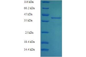 SDS-PAGE (SDS) image for RAB27B, Member RAS Oncogene Family (RAB27B) (AA 2-218) protein (His-SUMO Tag) (ABIN5710203)