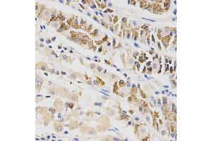 Immunohistochemistry of paraffin-embedded human stomach using BTRC antibody at dilution of 1:200 (x400 lens) (BTRC Antikörper)