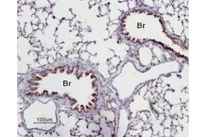 Expression of Adenosine A2A Receptor in rat lung - Immunohistochemical staining of paraffin emedded rat lung sections using Anti-Adenosine A2A Receptor Antibody (ABIN7042883, ABIN7043888 and ABIN7043889), (1:50). (Adenosine A2a Receptor Antikörper  (AA 201-215))