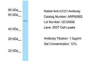 Western Blotting (WB) image for anti-CCZ1 Vacuolar Protein Trafficking and Biogenesis Associated Homolog (S. Cerevisiae) (CCZ1) (C-Term) antibody (ABIN2790029) (CCZ1 Antikörper  (C-Term))