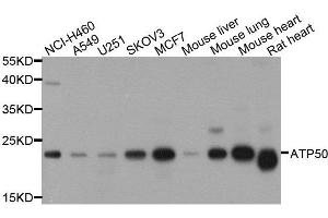 Western blot analysis of extracts of various cell lines, using ATP5O antibody. (ATP5O Antikörper  (AA 24-213))
