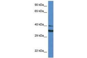 Image no. 1 for anti-NAD(P)H Dehydrogenase, Quinone 1 (NQO1) (AA 111-160) antibody (ABIN6747304) (NQO1 Antikörper  (AA 111-160))
