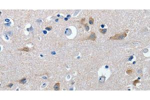 Immunohistochemistry of paraffin-embedded Human brain tissue using GAD2 Polyclonal Antibody at dilution 1:30 (GAD65 Antikörper)