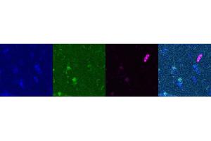 Immunohistochemistry (IHC) image for anti-Somatostatin (SST) antibody (ABIN7455980) (Somatostatin Antikörper)
