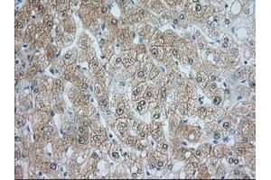 Image no. 2 for anti-Acetyl-CoA Acetyltransferase 2 (ACAT2) antibody (ABIN1496402) (ACAT2 Antikörper)