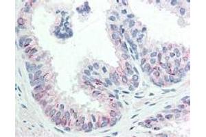 Immunohistochemistry (IHC) image for anti-V-Akt Murine Thymoma Viral Oncogene Homolog 1 (AKT1) (Ser473) antibody (ABIN400784) (AKT1 Antikörper  (Ser473))