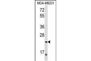 Western blot analysis in MDA-MB231 cell line lysates (35ug/lane). (PEX11A Antikörper  (AA 137-165))
