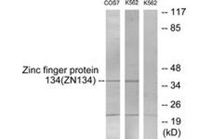 Western blot analysis of extracts from COS7/K562 cells, using ZNF134 Antibody. (ZNF134 Antikörper  (AA 116-165))