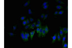 Immunofluorescent analysis of HepG2 cells using ABIN7153857 at dilution of 1:100 and Alexa Fluor 488-congugated AffiniPure Goat Anti-Rabbit IgG(H+L) (GLIPR1 Antikörper  (AA 22-232))