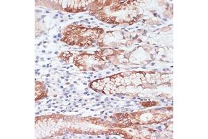 Immunohistochemistry of paraffin-embedded human stomach using Lysozyme (Lysozyme (LYZ)) antibody (ABIN6133802, ABIN6143409, ABIN6143412 and ABIN6217538) at dilution of 1:100 (40x lens). (LYZ Antikörper  (AA 1-100))