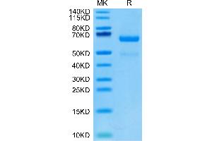 Human LRP10 on Tris-Bis PAGE under reduced condition. (LRP10 Protein (AA 17-440) (His tag))