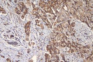 IHC analysis of TFAM using anti-TFAM antibody (ABIN7603113).