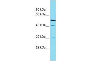 Western Blotting (WB) image for anti-Calcium Binding Protein 4 (CABP4) (C-Term) antibody (ABIN2789662)
