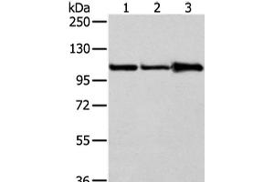 Western Blot analysis of A431, 231 and NIH/3T3 cell using AP2A1 Polyclonal Antibody at dilution of 1/250 (alpha Adaptin Antikörper)