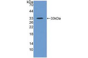 Western blot analysis of recombinant Human ITIH4. (ITIH4 Antikörper  (AA 683-928))