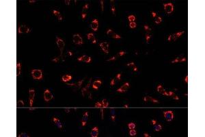Immunofluorescence analysis of L929 cells using PAH Polyclonal Antibody at dilution of 1:100. (Phenylalanine Hydroxylase Antikörper)