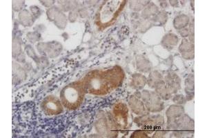 Image no. 6 for anti-Calcium Responsive Transcription Factor (CARF) (AA 621-719) antibody (ABIN599306) (Calcium Responsive Transcription Factor (CARF) (AA 621-719) Antikörper)