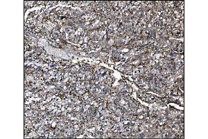 IHC analysis of CD39/ENTPD1 using anti-CD39/ENTPD1 antibody (ABIN7602461). (CD39 Antikörper  (AA 79-411))