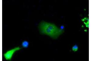 Immunofluorescence (IF) image for anti-Bruton Agammaglobulinemia tyrosine Kinase (BTK) antibody (ABIN1496975) (BTK Antikörper)