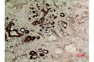 Immunohistochemical analysis of paraffin-embedded human-breast, antibody was diluted at 1:100.