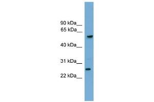 WB Suggested Anti-GZMA Antibody Titration: 0. (GZMA Antikörper  (C-Term))
