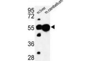Western Blotting (WB) image for anti-Ubiquitin Associated Protein 1 (UBAP1) antibody (ABIN3003932) (UBAP1 Antikörper)