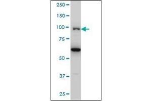 Western Blotting (WB) image for anti-Oculocerebrorenal Syndrome of Lowe (OCRL) (AA 146-240) antibody (ABIN782420) (OCRL Antikörper  (AA 146-240))