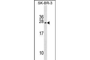TUSC5 Antibody (Center) (ABIN1538619 and ABIN2849448) western blot analysis in SK-BR-3 cell line lysates (35 μg/lane). (TUSC5 Antikörper  (AA 78-104))
