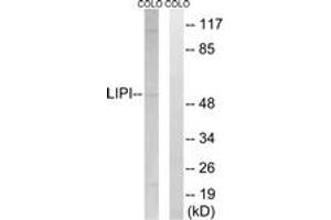 Western blot analysis of extracts from COLO cells, using LIPI Antibody. (Lipase I Antikörper  (AA 289-338))