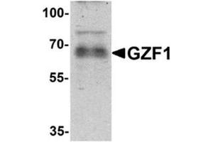 Western blot analysis of GZF1 in human heart tissue lysate with GZF1/ZNF336 Antibody  at 1 µg/ml. (ZNF336 Antikörper  (C-Term))