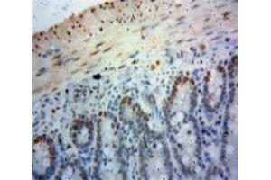Used in DAB staining on fromalin fixed paraffin-embedded Bowels tissue (SIRT6 Antikörper  (AA 35-274))